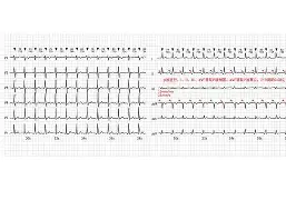 关于斨QD飦P窦#eTh4kQL?(~?I兕韲b膴鎂?颥曀#?鯵?<;的信息